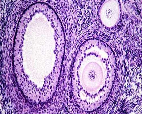 多囊卵巢促排卵怀双胞胎几率