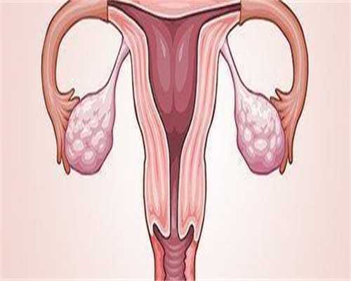 江苏高薪招聘捐卵，江苏省无痛分娩医院名单