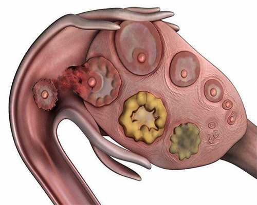 苏州专业助孕，苏州做试管费用取决于哪些因素?