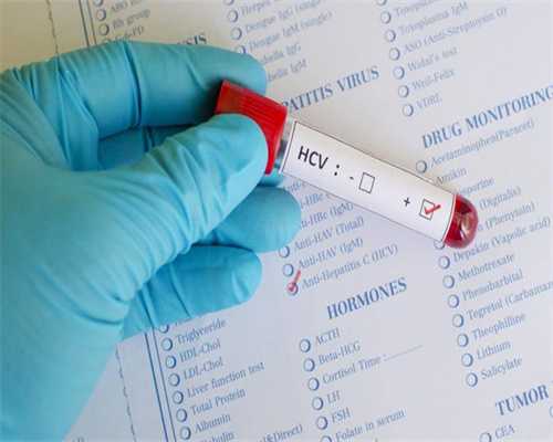 强的松最多能吃多久?须视患者所患的病症所决定