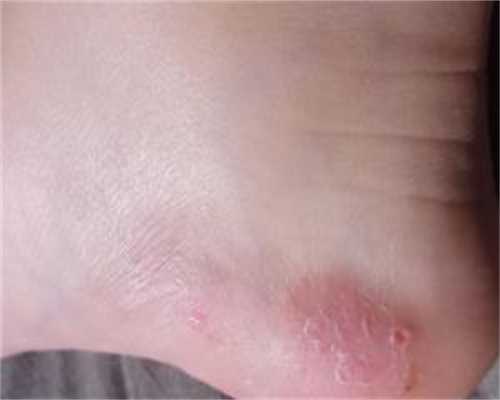 借卵试管排名:试管婴儿技术哪里好?在深圳去哪里做试管婴儿比较好，成功率如何