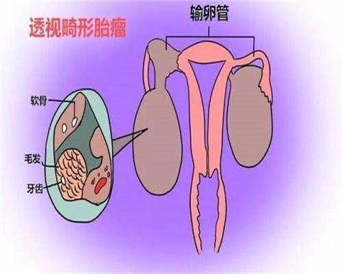 苏州助孕群，苏州做试管婴儿多少钱？