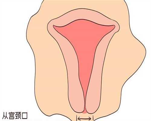 咨询中国代孕机构_试管生龙凤胎多少钱,试管移植血压高的影响,放任不管只会影