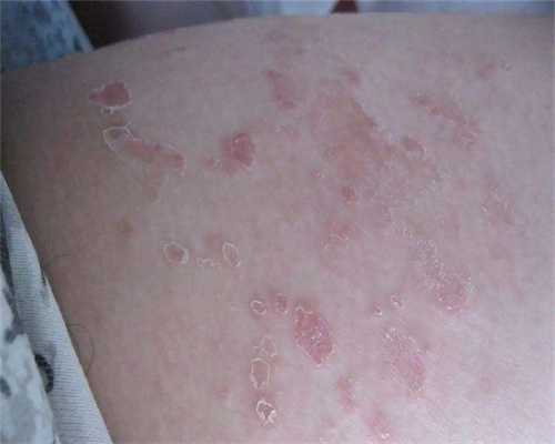 连云港做试管婴儿要多少钱？