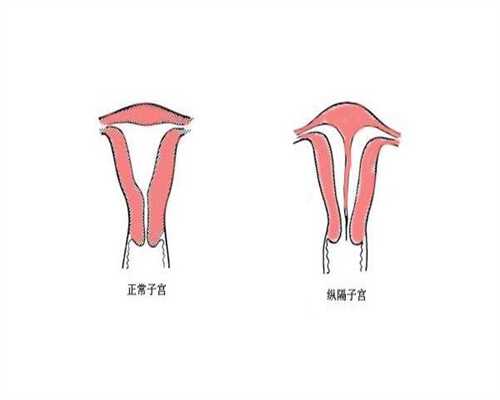试管婴儿助孕中心：生殖器硬了试管婴儿移植13天阴性中间部分疼？