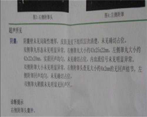 阴道炎的四大“隐患”，你不可不知！