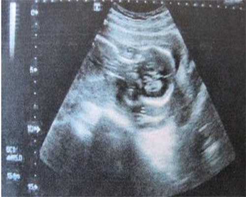 江苏供卵市场价-江苏供卵不排队医院