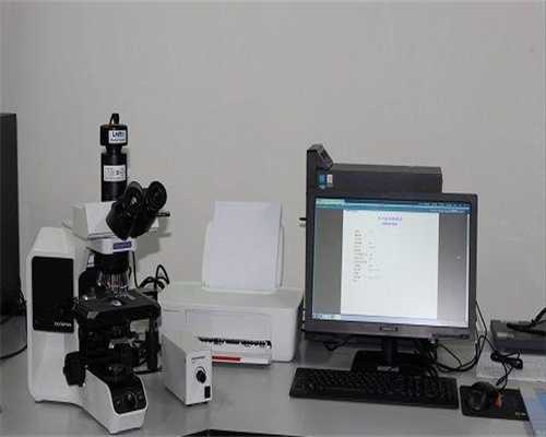 卵巢功能检查项目amh