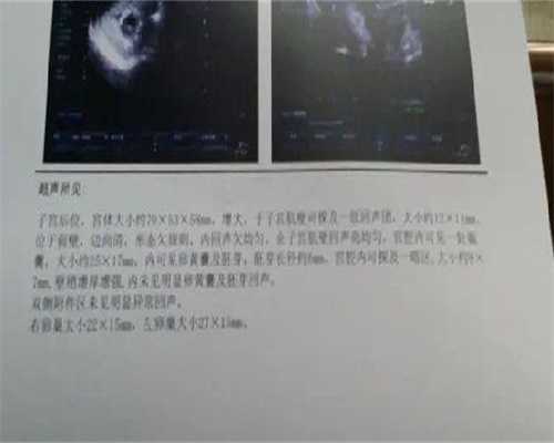 江苏供卵公司排名，江苏省供卵试管婴儿多少钱