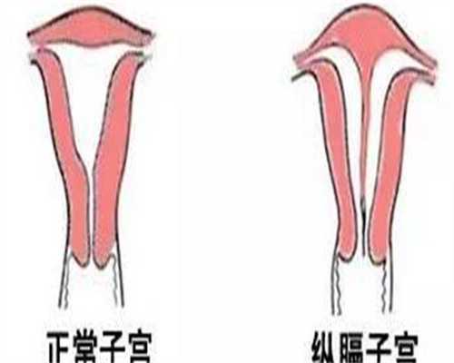 内分泌紊乱的8个征兆，你需要知道