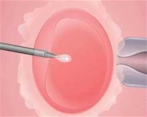 苏州单身供卵，做试管婴儿苏州哪家医院好