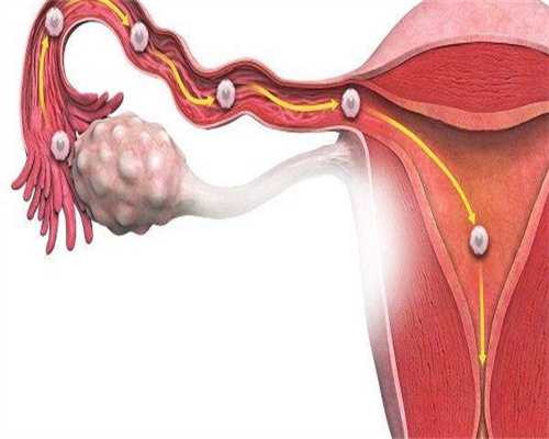 深入解读子宫肌瘤：发展探究与症状揭示